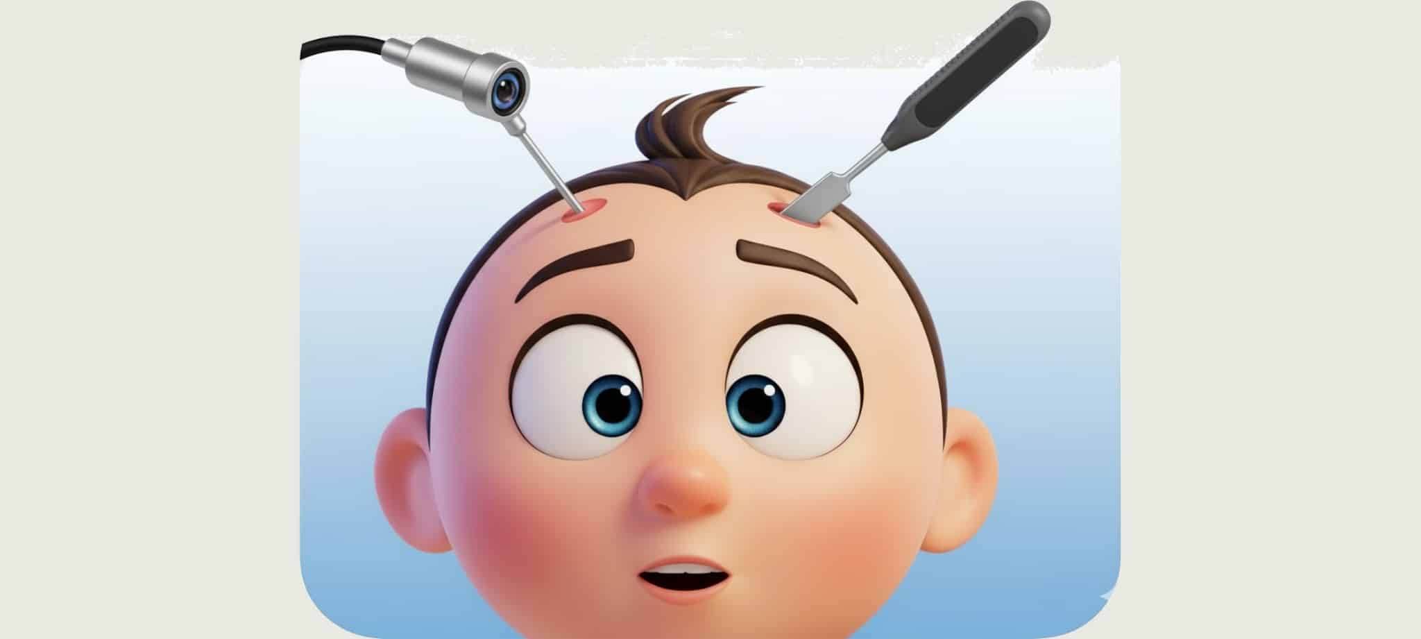 內視鏡前額拉皮可以無痕改善眉壓眼 抬頭紋