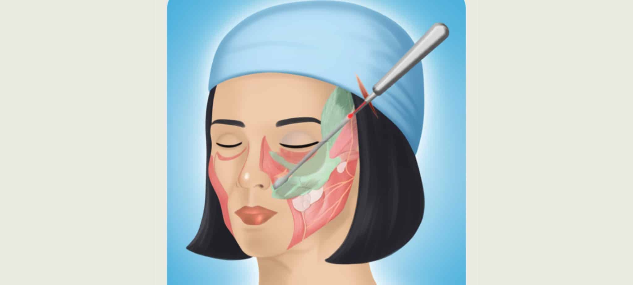 內視鏡筋膜拉提 真正做到放鬆提拉 固定的作用