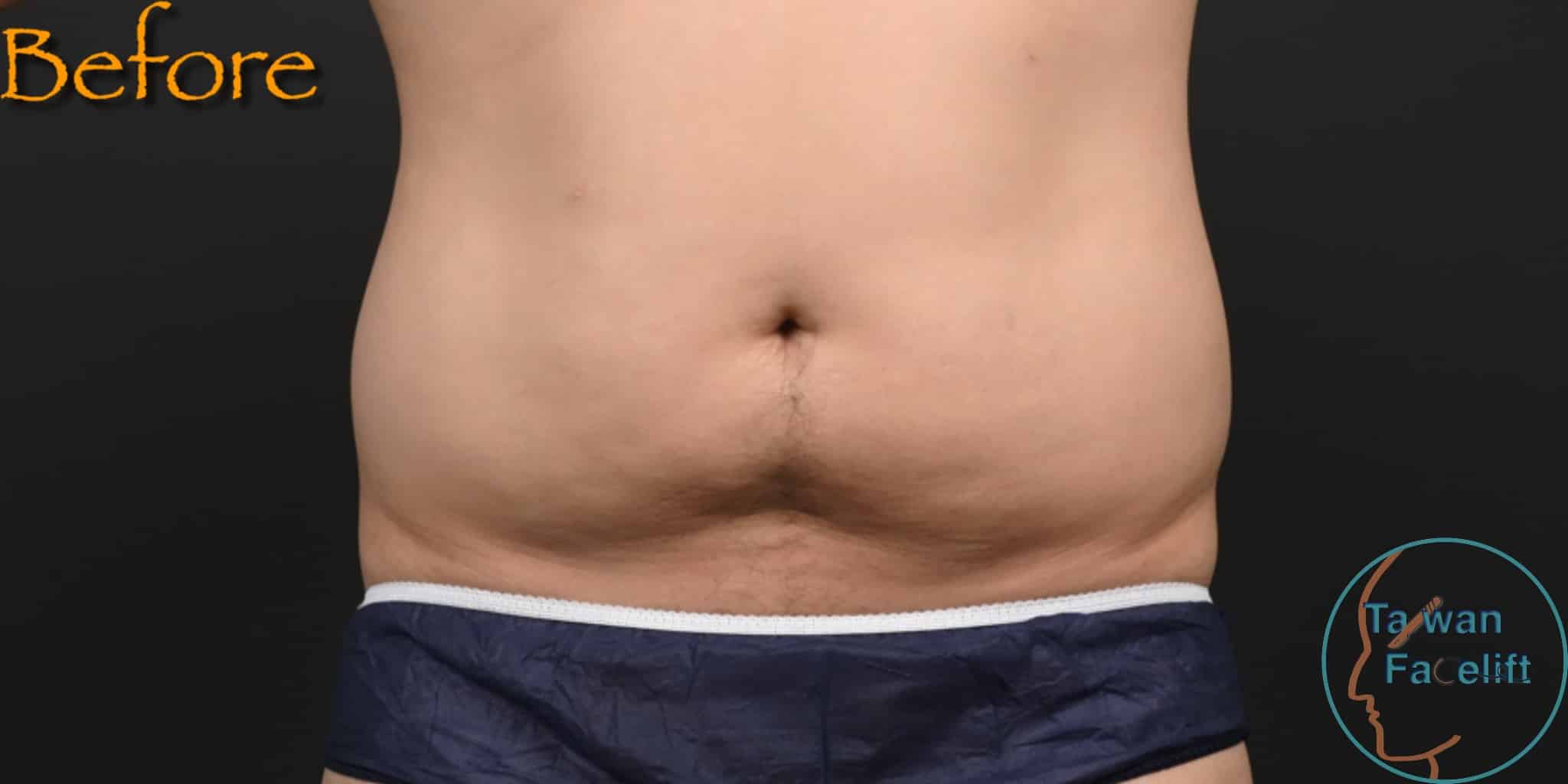 Before image alt