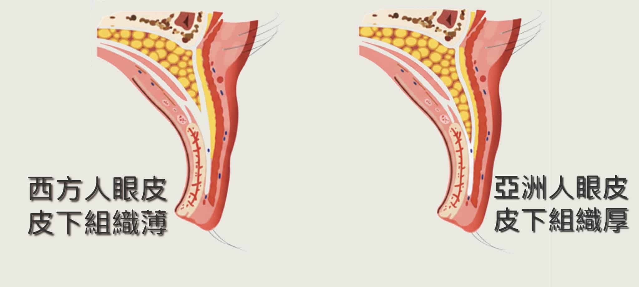 西方人眼皮組織較薄 亞洲人眼皮組織較厚