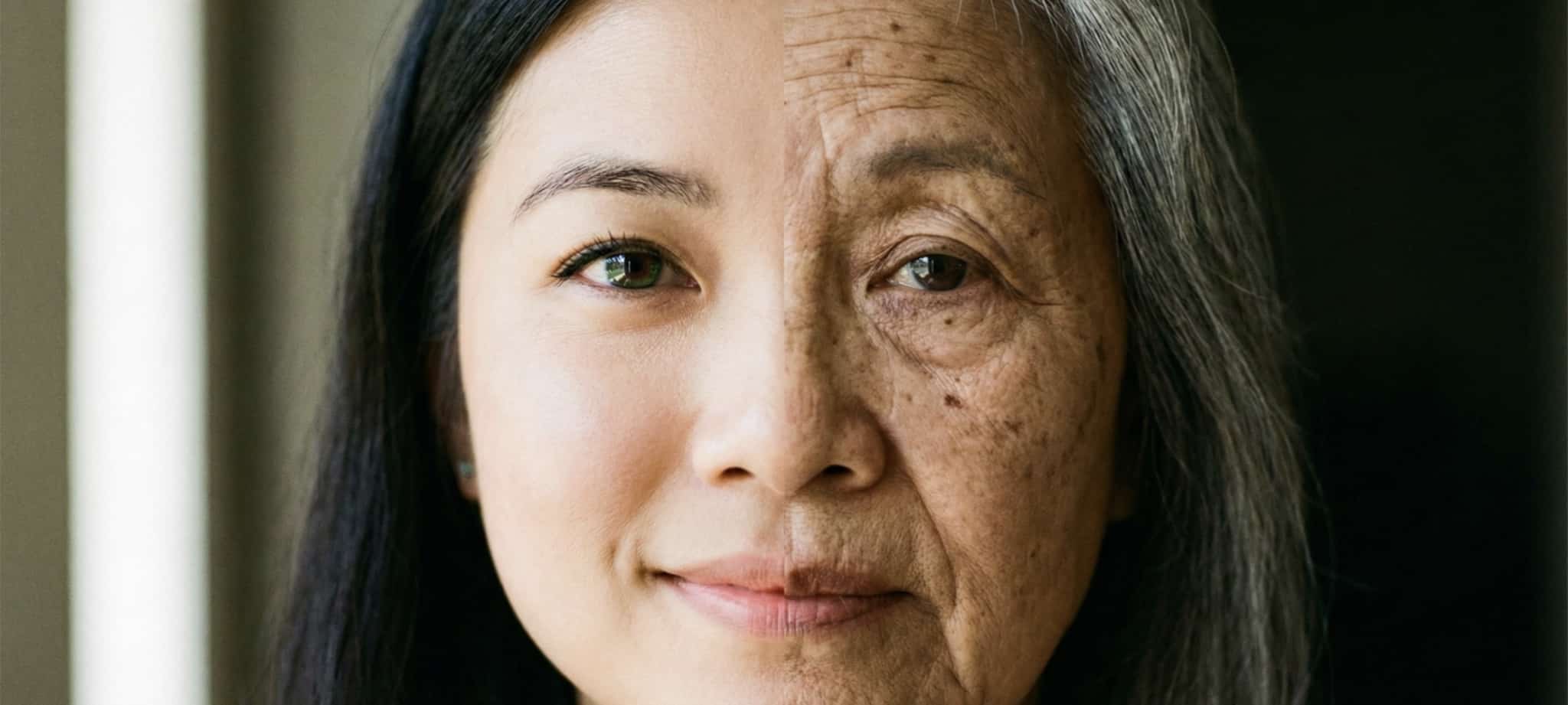 臉部老化的成因包括萎縮和鬆弛