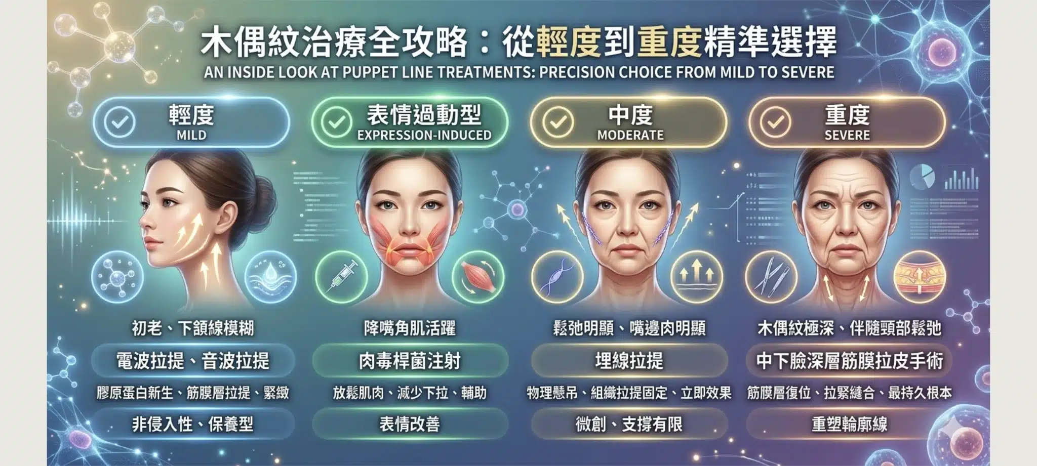 木偶紋是什麼?如何消除?整形外科醫師揭開木偶紋與嘴邊肉的下垂真相 3 改善木偶紋的適合醫美治療方式