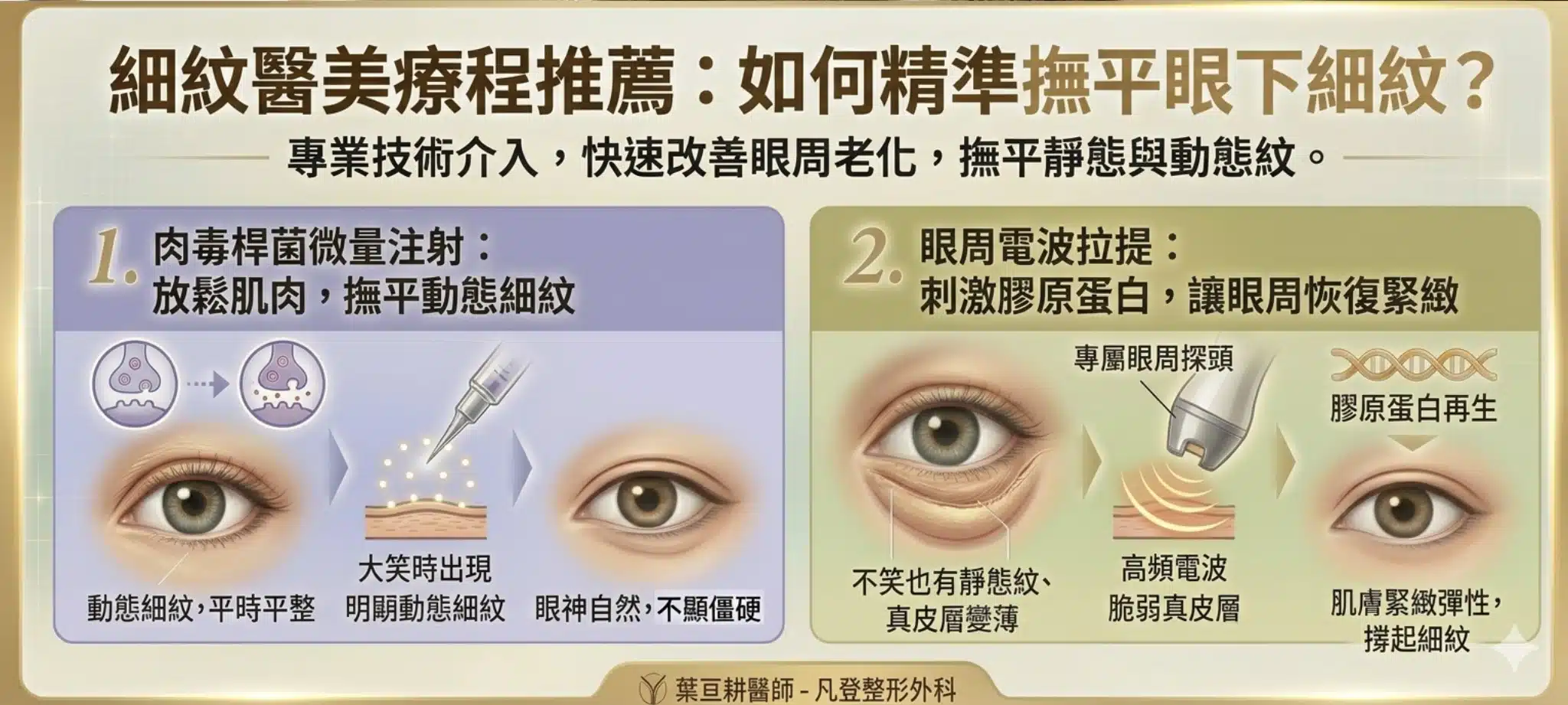 眼下細紋怎麼辦?眼周肌膚問題與改善方法全解析:成因、保養與醫美療程推薦 2 常見眼下細紋醫美療程