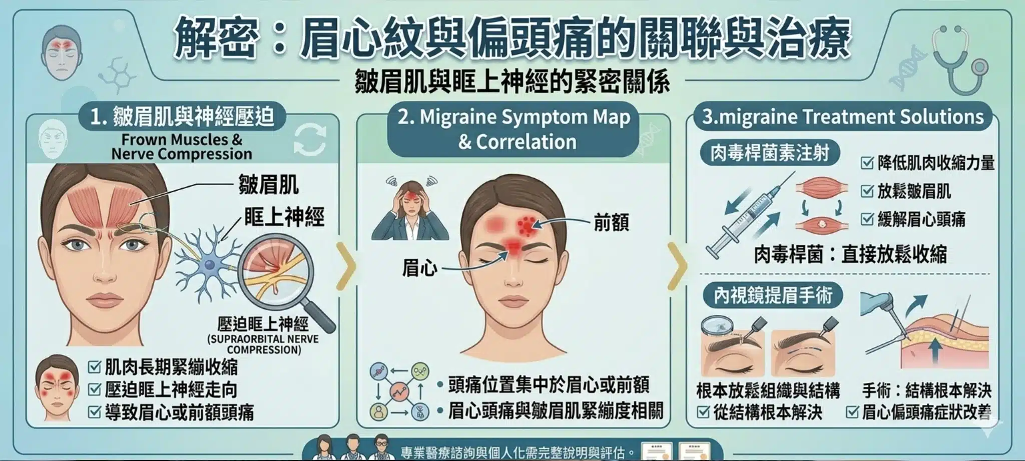 皺眉紋是什麼?皺眉紋的成因、治療效果與肉毒桿菌素注射全解析 3 皺眉紋改善也可以改善偏頭痛