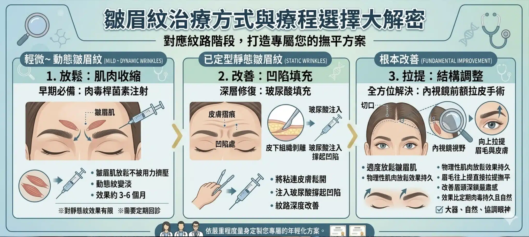 皺眉紋是什麼?皺眉紋的成因、治療效果與肉毒桿菌素注射全解析 2 皺眉紋的醫美治療方式