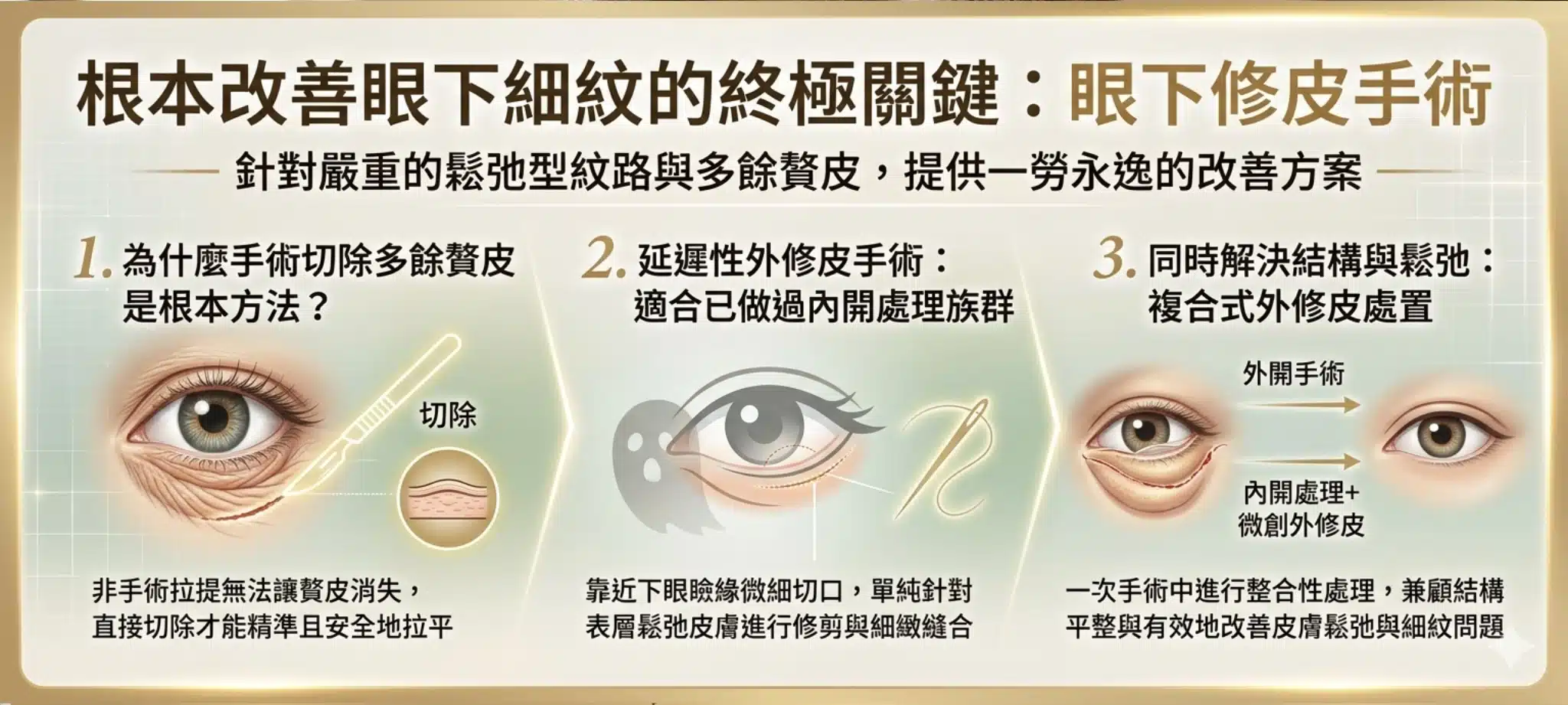 眼下細紋怎麼辦?眼周肌膚問題與改善方法全解析:成因、保養與醫美療程推薦 3 眼下細紋根本改善方式-修皮手術